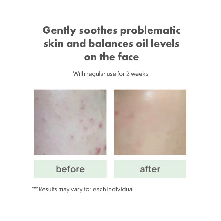 MuldreamMuldream Vegan Green Mild FRESH CICA Serum Toner 110ml8809443284037